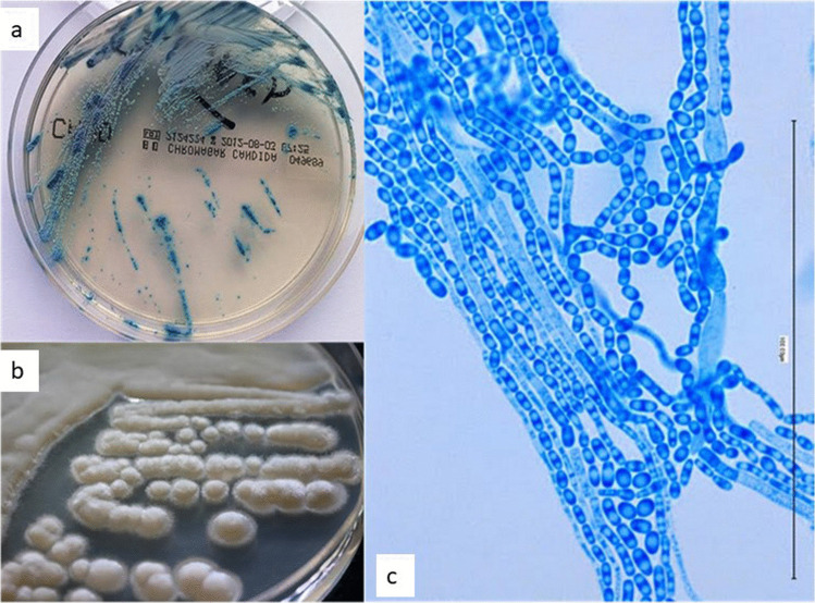 Trichosporon asahii study figure
